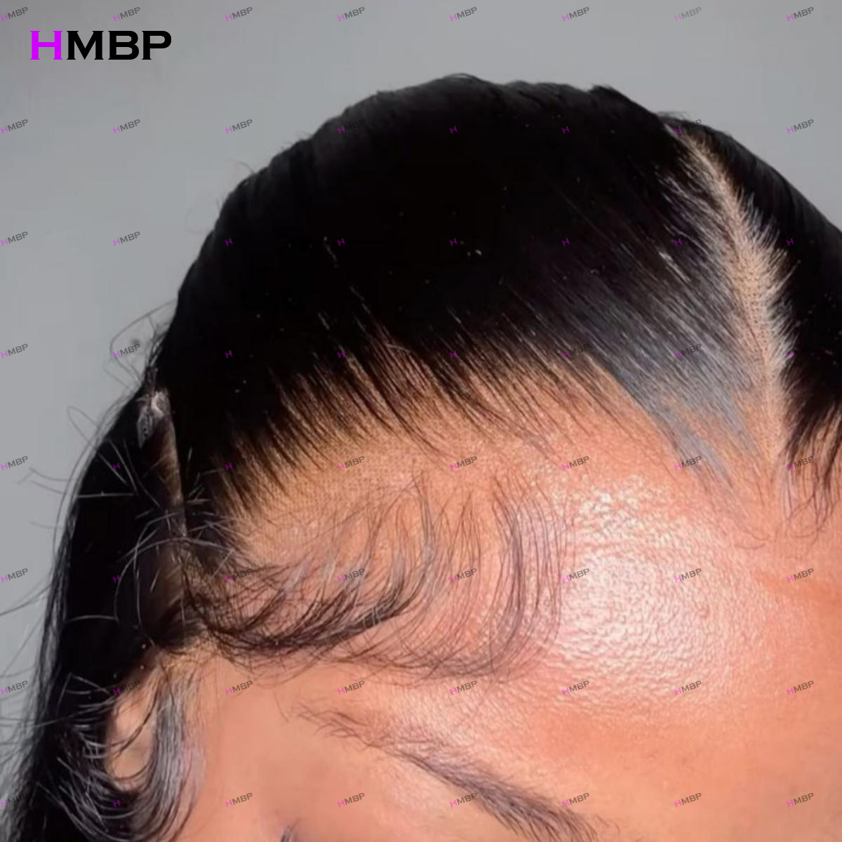 Hd Lace Frontal Wig Human Hair Pre Plucked - M-shaped Hairline Body Wave Human Hair